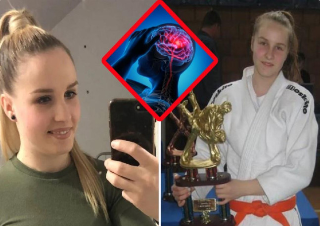 Simptomi moždanog udara od kojeg je umrla Neda Davidović: Ona je osetila samo 1, a mnogi ga ignorišu - featured image