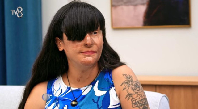 “Nakon raskida polio je kiselinom,oslijepio je i unakazio – Ona nakon 2 godine donijela sok odluku” Borio se za nju 2 godine…” - featured image