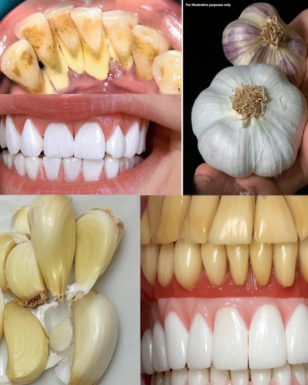 Prirodno do zdravijeg osmeha: Kako beli luk može poboljšati zdravlje zuba i desni… - featured image