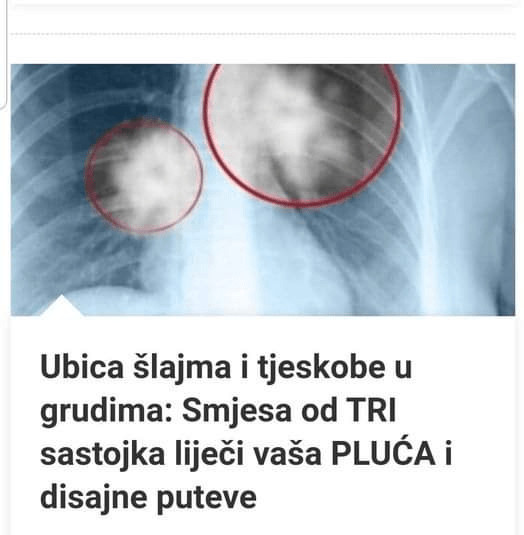 Ubojica sluzi i tjeskobe u prsima: Mješavina tri sastojka za liječenje pluća i dišnih putova… - featured image